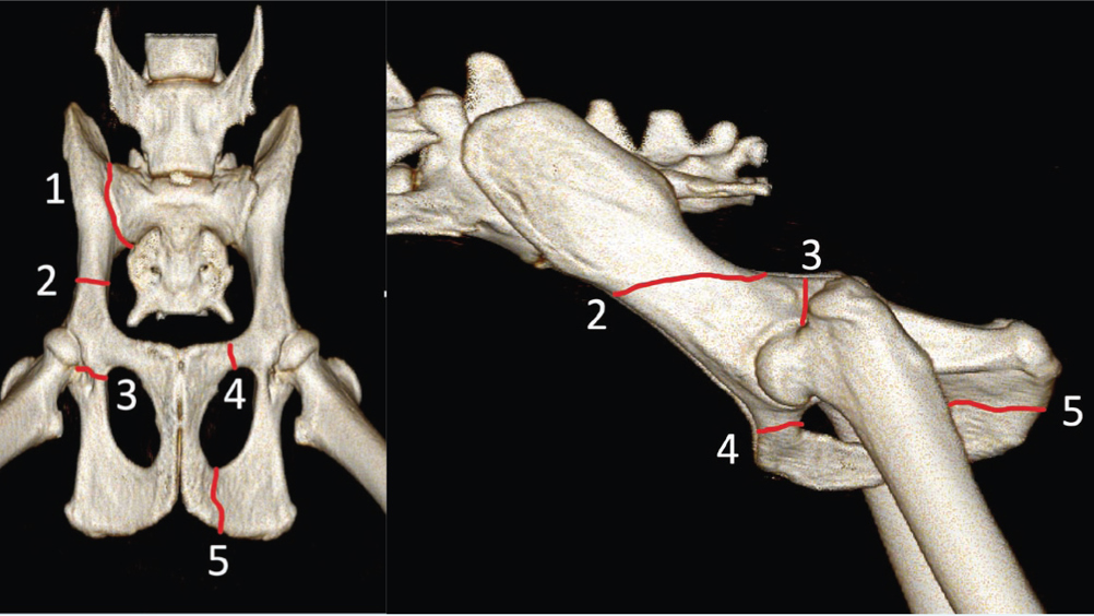 Figure 1. Common fracture locations that are generally found in combination. (1) Sacroiliac luxation. (2) Iliac body fracture. (3) Acetabular fracture. (4) Pubic fracture. (5) Ischial fracture.