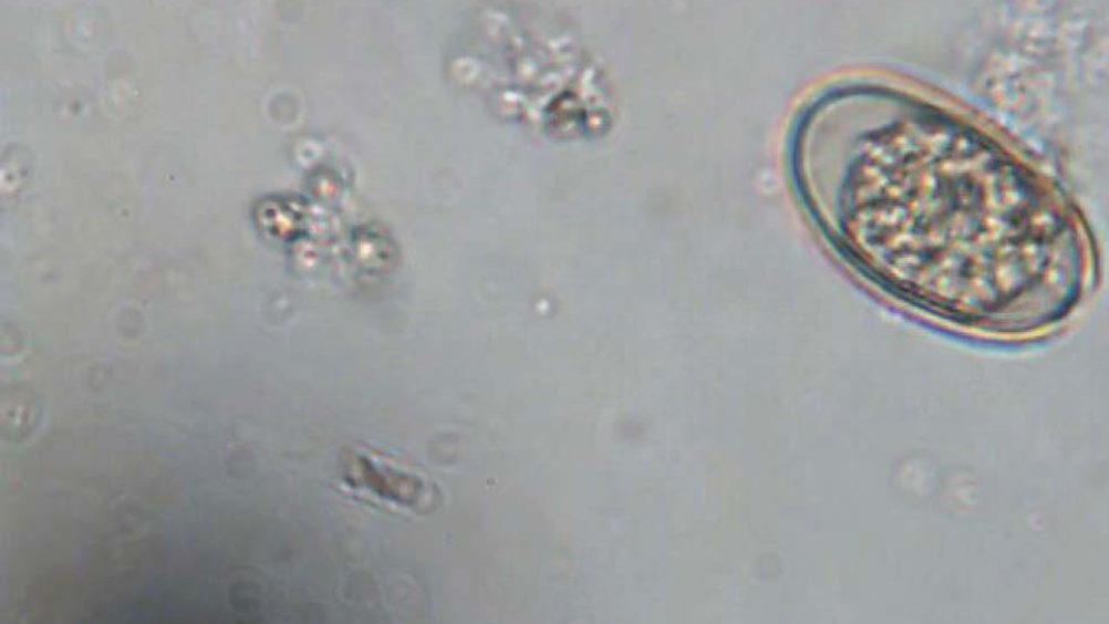 Figure 1. Eimeri stiedai oocyst in a faecal float – note the typical ovoid appearance.