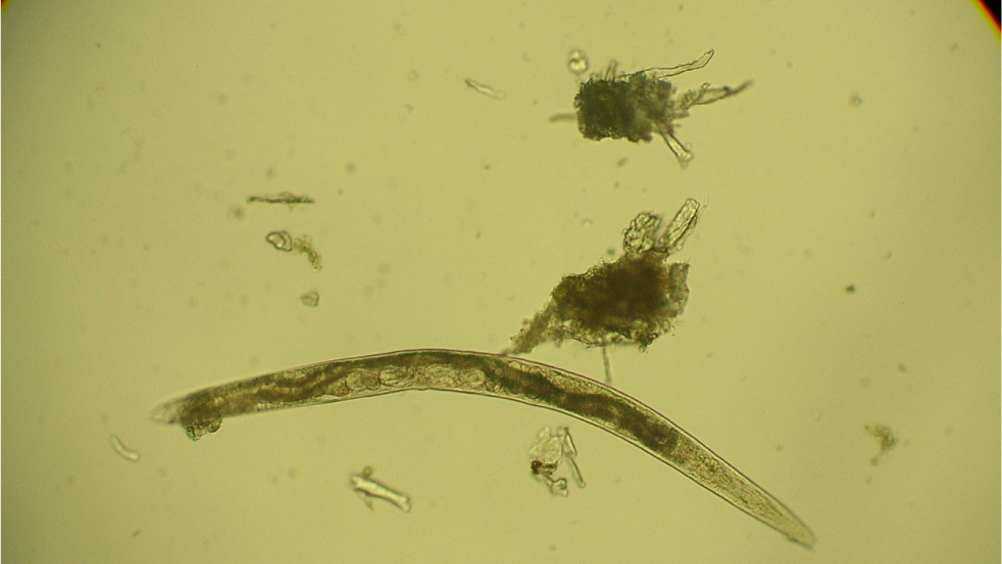 Figure 1. Free living nematode contaminating faecal sample.