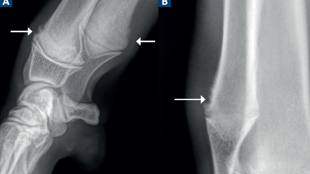 Figure 1. Mediolateral (A) and close-up dorsopalmar (B) of the right carpus of two different dogs. The arrows demonstrate metaphyseal irregularity in a skeletally immature large breed patient, consistent with a normal cutback zone.