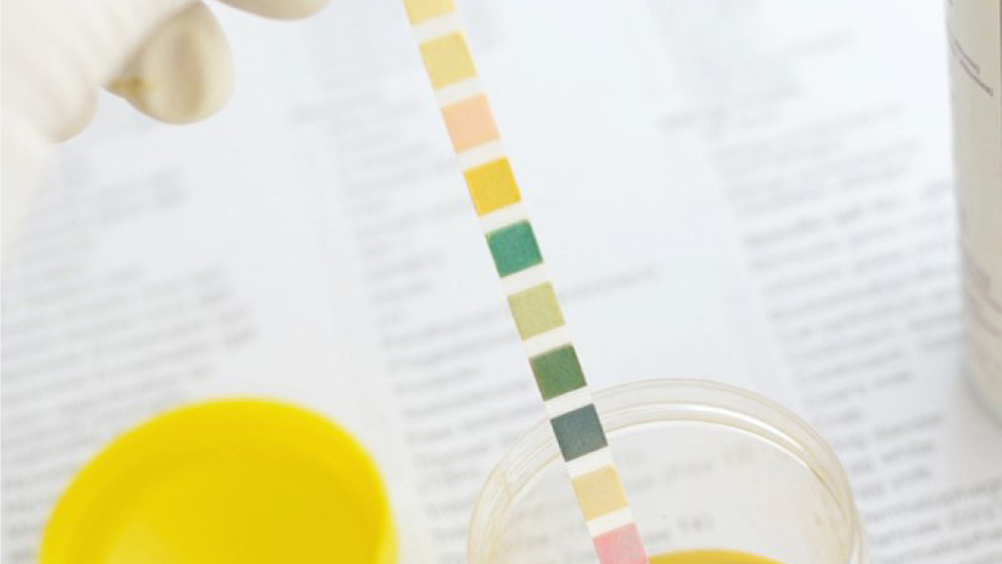 Figure 1. Urine dipstick.